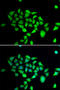 Dipeptidyl Peptidase 8 antibody, STJ29193, St John
