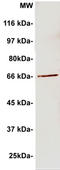 Protein LYRIC antibody, TA354924, Origene, Western Blot image 