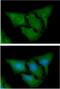 Heat Shock Protein Family A (Hsp70) Member 5 antibody, GTX57602, GeneTex, Immunofluorescence image 