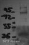 Thrombomodulin antibody, ab6980, Abcam, Western Blot image 
