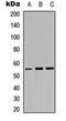 Protein Kinase, Membrane Associated Tyrosine/Threonine 1 antibody, orb315654, Biorbyt, Western Blot image 