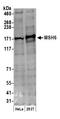 MutS Homolog 6 antibody, A300-022A, Bethyl Labs, Western Blot image 