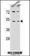 Serine Protease 55 antibody, 56-019, ProSci, Western Blot image 