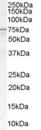 Acyl-CoA Synthetase Long Chain Family Member 5 antibody, EB07250, Everest Biotech, Western Blot image 