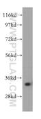 Aldose reductase antibody, 15439-1-AP, Proteintech Group, Western Blot image 