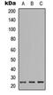 Phosphatidylinositol-glycan biosynthesis class F protein antibody, abx121553, Abbexa, Western Blot image 