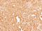 Coagulation Factor X antibody, GTX110300, GeneTex, Immunohistochemistry paraffin image 