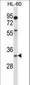 Egl-9 Family Hypoxia Inducible Factor 3 antibody, LS-C167663, Lifespan Biosciences, Western Blot image 