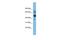 Serine Hydroxymethyltransferase 1 antibody, PA5-43278, Invitrogen Antibodies, Western Blot image 