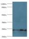 Nucleolar Protein 3 antibody, MBS7002439, MyBioSource, Western Blot image 