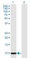 Thymosin Beta 4 Y-Linked antibody, H00009087-M05, Novus Biologicals, Western Blot image 