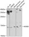 Methionine-R-sulfoxide reductase B1 antibody, GTX65818, GeneTex, Western Blot image 