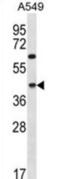 Mitochondrial Calcium Uniporter Dominant Negative Beta Subunit antibody, abx026751, Abbexa, Western Blot image 