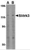SLIK3 antibody, NBP2-81815, Novus Biologicals, Western Blot image 
