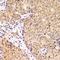 2'-5'-Oligoadenylate Synthetase 1 antibody, LS-C667654, Lifespan Biosciences, Immunohistochemistry paraffin image 