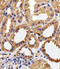 Calpain 1 antibody, M01943-1, Boster Biological Technology, Immunohistochemistry paraffin image 
