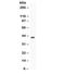 Complement Factor D antibody, R31875, NSJ Bioreagents, Western Blot image 