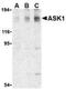 Mitogen-Activated Protein Kinase Kinase Kinase 5 antibody, NBP1-76674, Novus Biologicals, Western Blot image 