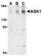 ASK-1 antibody, NBP1-76674, Novus Biologicals, Western Blot image 