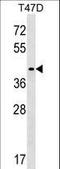 Metabolism Of Cobalamin Associated D antibody, LS-C158154, Lifespan Biosciences, Western Blot image 