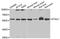 Staufen Double-Stranded RNA Binding Protein 1 antibody, A4131, ABclonal Technology, Western Blot image 
