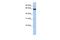 Galectin 3 Binding Protein antibody, PA5-44212, Invitrogen Antibodies, Western Blot image 