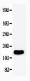 Fibroblast Growth Factor 1 antibody, PA1311, Boster Biological Technology, Western Blot image 
