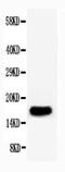 Heparin-binding growth factor 1 antibody, PA1311, Boster Biological Technology, Western Blot image 