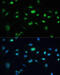 Transient Receptor Potential Cation Channel Subfamily A Member 1 antibody, 23-662, ProSci, Immunohistochemistry frozen image 