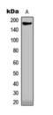 Collagen Type XVIII Alpha 1 Chain antibody, orb393249, Biorbyt, Western Blot image 