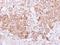 Bone Morphogenetic Protein 15 antibody, NBP2-14888, Novus Biologicals, Immunohistochemistry frozen image 