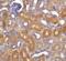 DNA fragmentation factor subunit beta antibody, 2416, QED Bioscience, Immunohistochemistry paraffin image 