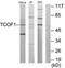 Treacle Ribosome Biogenesis Factor 1 antibody, orb96507, Biorbyt, Western Blot image 