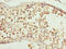 Cilia And Flagella Associated Protein 52 antibody, CSB-PA839781LA01HU, Cusabio, Immunohistochemistry paraffin image 