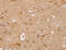 Tripartite Motif Containing 34 antibody, CSB-PA147931, Cusabio, Immunohistochemistry paraffin image 