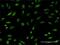 PTTG1 Regulator Of Sister Chromatid Separation, Securin antibody, H00009232-M11, Novus Biologicals, Immunocytochemistry image 