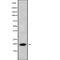 Inner Mitochondrial Membrane Peptidase Subunit 1 antibody, abx216227, Abbexa, Western Blot image 