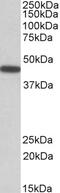 Electron Transfer Flavoprotein Dehydrogenase antibody, 42-621, ProSci, Enzyme Linked Immunosorbent Assay image 