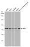 NDC80 Kinetochore Complex Component antibody, GTX70268, GeneTex, Western Blot image 