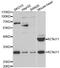 Potassium Voltage-Gated Channel Subfamily J Member 11 antibody, LS-C334272, Lifespan Biosciences, Western Blot image 