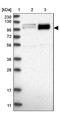 Peroxisomal Biogenesis Factor 6 antibody, PA5-55267, Invitrogen Antibodies, Western Blot image 
