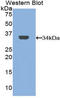 Mannose Receptor C-Type 1 antibody, LS-C295293, Lifespan Biosciences, Western Blot image 