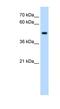 Serine/Threonine/Tyrosine Kinase 1 antibody, NBP1-59491, Novus Biologicals, Western Blot image 