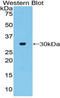 Adenylate Cyclase 2 antibody, LS-C292639, Lifespan Biosciences, Western Blot image 