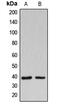 Beta-1,3-Galactosyltransferase 1 antibody, GTX55180, GeneTex, Western Blot image 