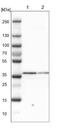 Secretory Carrier Membrane Protein 2 antibody, NBP1-89543, Novus Biologicals, Western Blot image 
