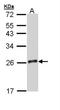 Growth Hormone 2 antibody, NBP1-33321, Novus Biologicals, Western Blot image 