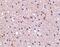 Nicastrin antibody, PA5-20304, Invitrogen Antibodies, Immunohistochemistry paraffin image 