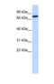 Delta Like Canonical Notch Ligand 1 antibody, NBP1-59217, Novus Biologicals, Western Blot image 