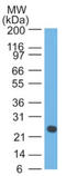 Ig lambda-1 chain C regions antibody, AM32823PU-T, Origene, Western Blot image 